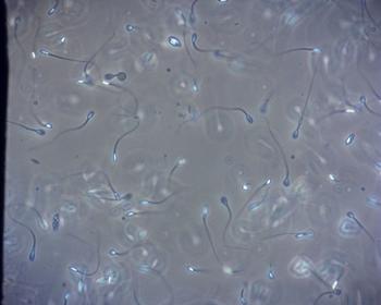 Mikroskopische Untersuchung der Spermien
