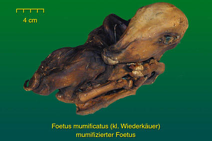 Mumifizierter Fötus - Präparat 2 weitere Ansicht