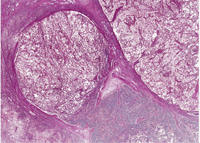 Histologie: Ausschnitt Lymphknoten, Kopf (Zoomify)