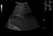Abb.1: Ultrasonographie der Bauchhöhle