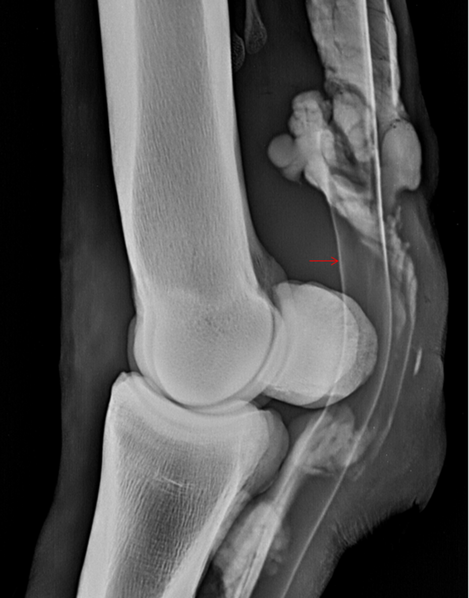 Kontrastmittelstudie zur Darstellung der Manica Flexoria • Zentrum für