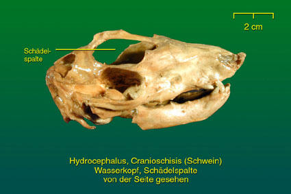 Wasserkopf mit Schädelspalte - weitere Ansicht