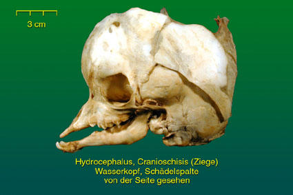 Wasserkopf mit Schädelspalte - weitere Ansicht