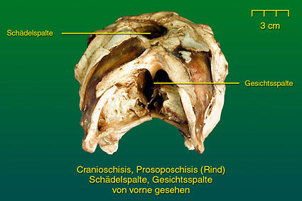 Schädel- und Gesichtsspalte - Präparat 2