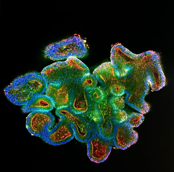 Darm-Organoid aus den Stammzellen vom Dünndarm eines Schweines