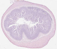 Histologie: intestinale Kokkzidiose