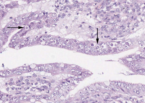 Histologisches Bild vom Darm einer Katze mit Kokzidiose