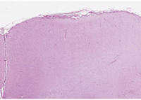 Histologie: Leptomeninx, Großhirn (Zoomify)