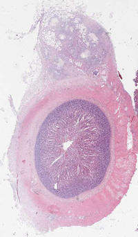 Histologie: Darmbiopsie bei Protein-Losing Enteropathy (Zoomify)