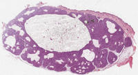 Histologie: Trichofollikulom