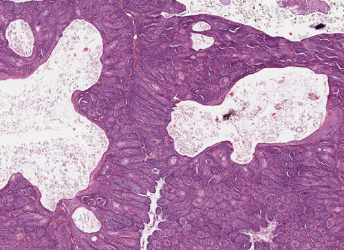 Histologisches Bild eines TRichofollikuloms bei einem Meerschweinchen