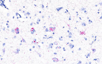 Molekularbiologischer Nachweis des Rustrelavirus 