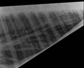 Fig.7: X-ray of the lungs