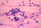 Fig.8: Cytological examination