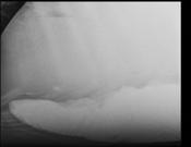 Fig.3: Sand in the X-ray image