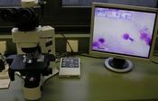 Fig.2: Microscopic examination
