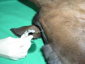 Fig.3: Cerebrospinal fluid puncture