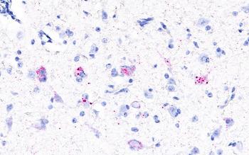 Molekularbiologischer Nachweis des Rustrelavirus (rote Punkte) in Nervenzellen eines Rotnackenwallaby.